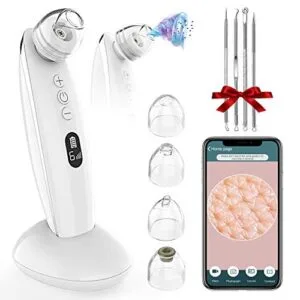 Vitcoco Blackhead Remover with Camera